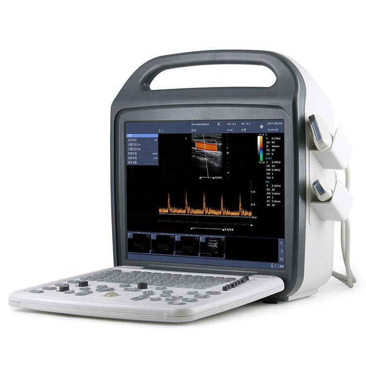 4D Ultrasound Machine
