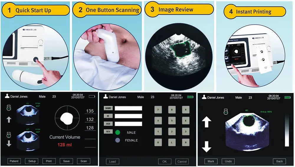 Bladder Volume Tester I Bladder Scan I MD-6000 — Meubon