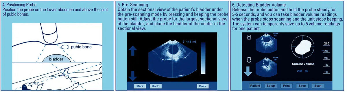 Bladder Volume Tester I Bladder Scan I MD-6000 - bladder