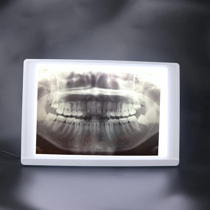 Hospital Lab Equipment X-Ray Film Illuminator Light Box