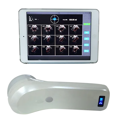 4D Wireless Bladder Scanner Bladder ultrasound