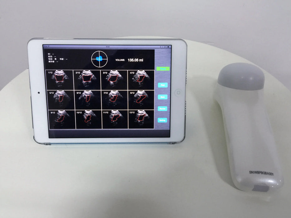 4D Wireless Bladder Scanner Bladder ultrasound — Meubon