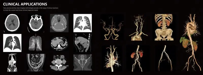 32 Slice CT Scanner – Advanced Medical Computed Tomography Machine for Precise Imaging