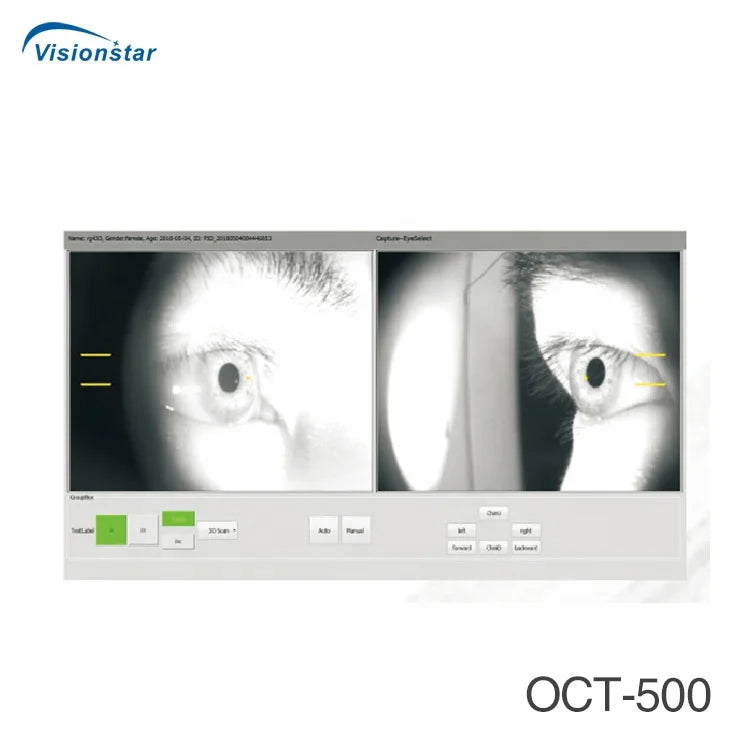 Optical Coherence Tomography Ophthalmology OCT Machine for Eye Exam I ...