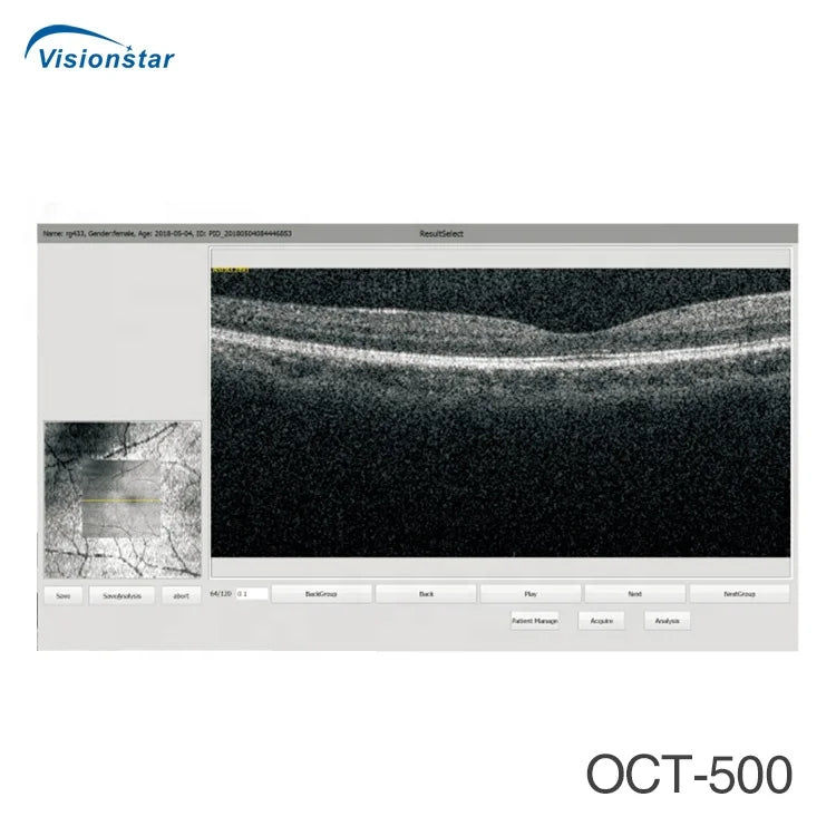 Optical Coherence Tomography Ophthalmology OCT Machine for Eye Exam I ...